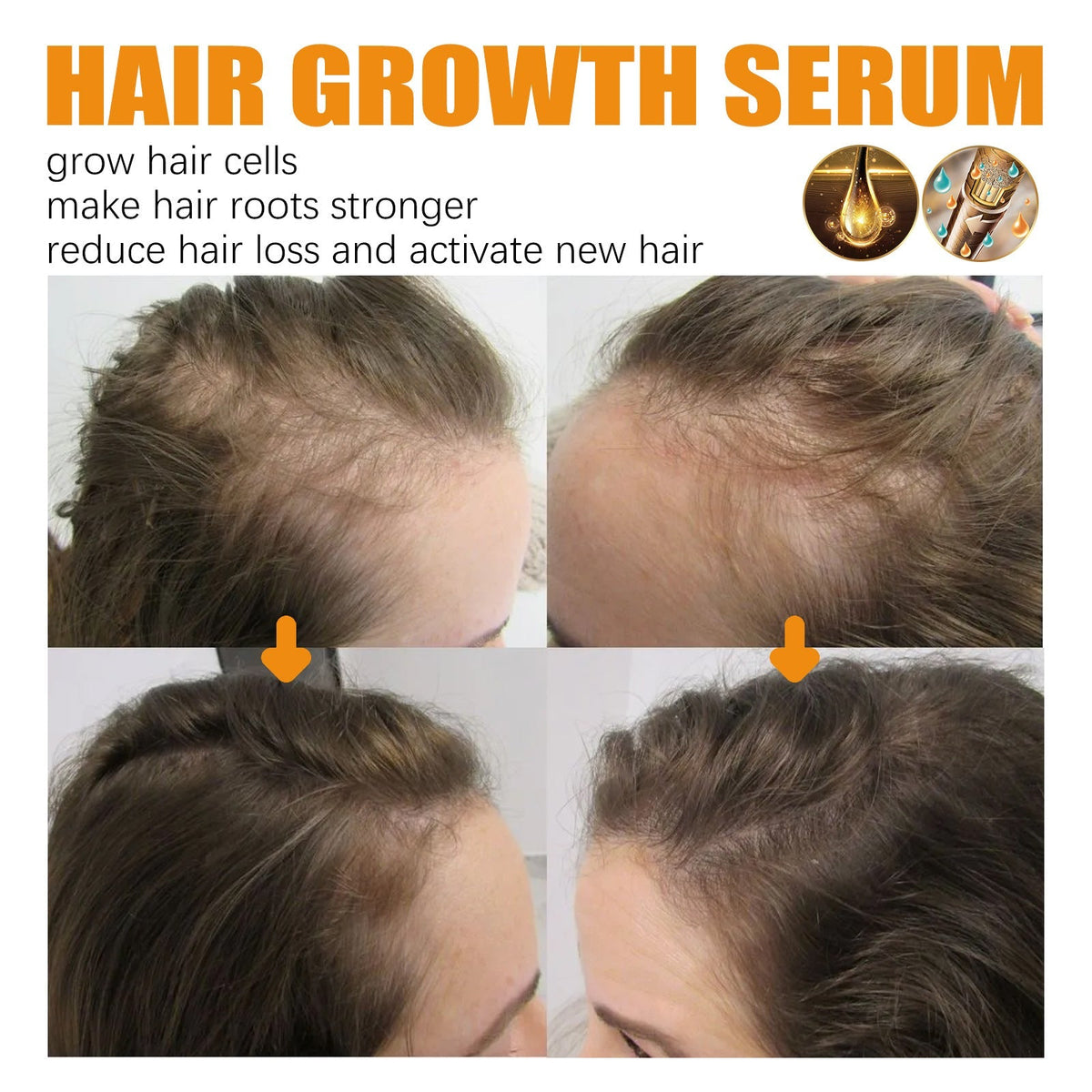 HairBoost Growth Essence